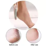 Electric Foot File Hard Skin Remover