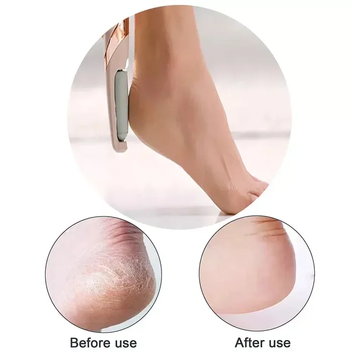 Salon quality pedicure device